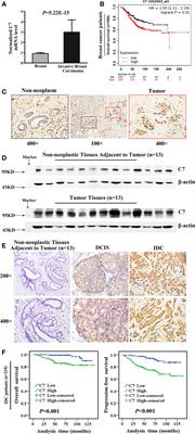 High Expression of Complement Component C7 Indicates Poor Prognosis of Breast Cancer and Is Insensitive to Taxane-Anthracycline Chemotherapy